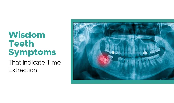 wisdom teeth symptoms that indicate time extraction