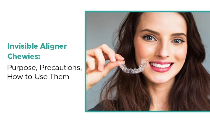 invisible aligner chewies