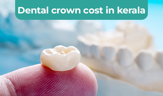 Dental crown cost in kerala