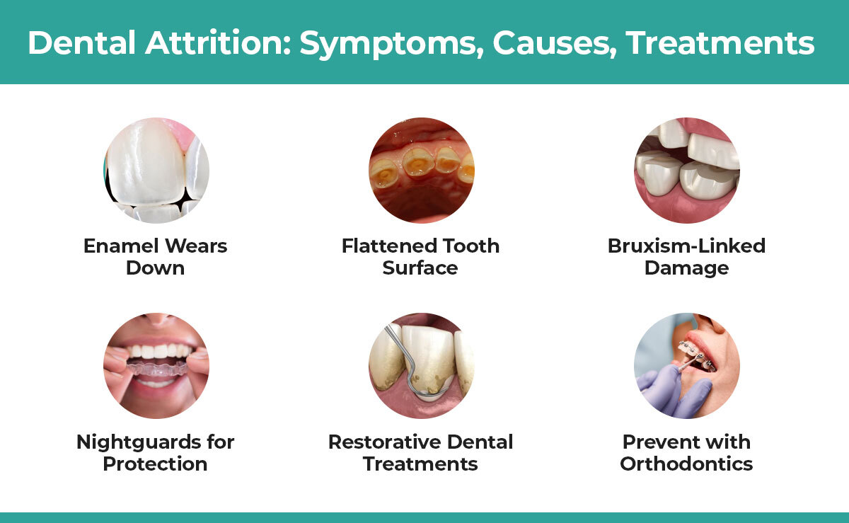 Dental-Attrition-Info