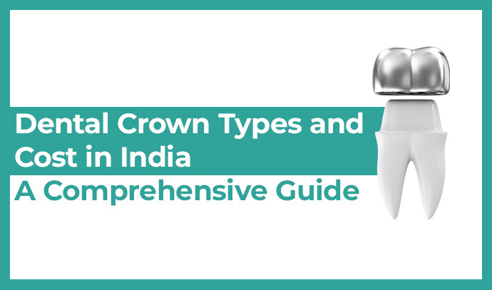Dental Crown Types and Cost in India – A Comprehensive Guide