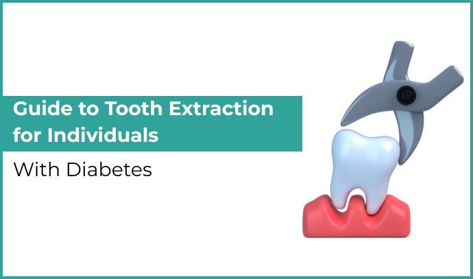 Guide to Tooth Extraction for Individuals With Diabetes