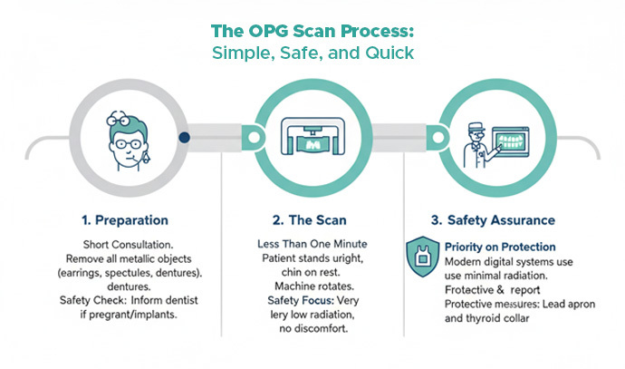 the OPG process, step by step