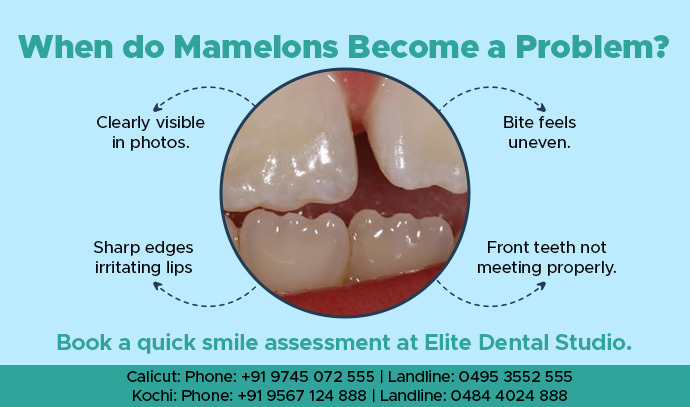 When do Mamelons Become a Problem