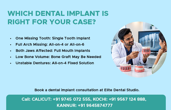 which dental implant is right for your case